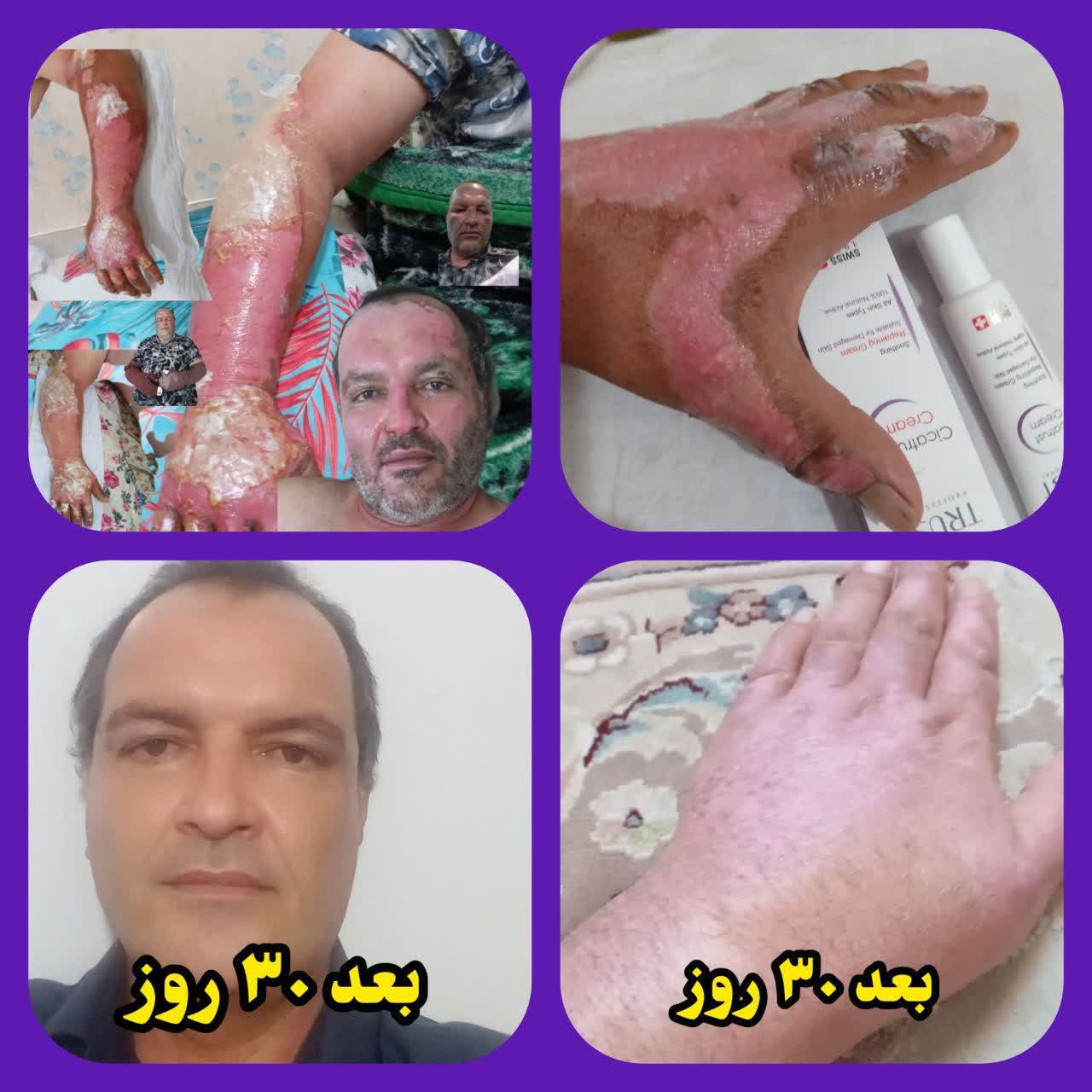 بهبود سریع 